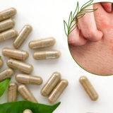 Anti-inflammatory